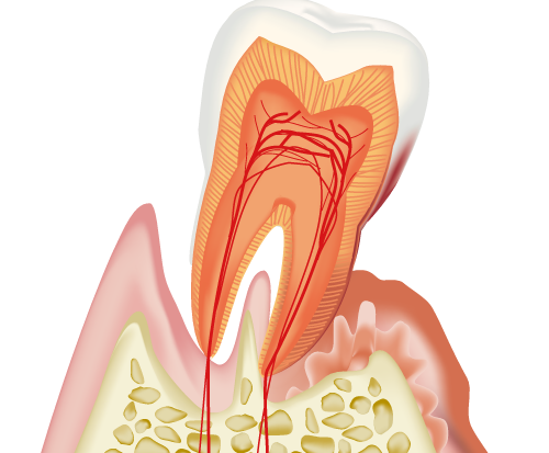 歯周病とは？